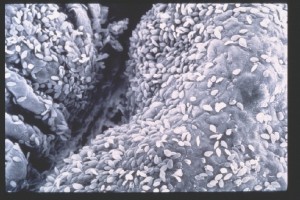 Costia under an electron microscope