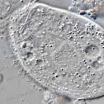 Chilodonella under a microscope