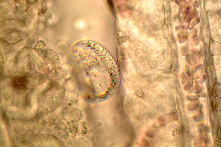 Chilodonella viewed at 400x under a miscrope||Single chilodonella in a microscope|Chilodonella in a microscope